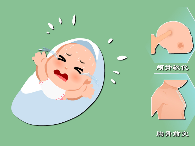 婴儿佝偻病睡姿图片(宝宝佝偻病的早期症状)