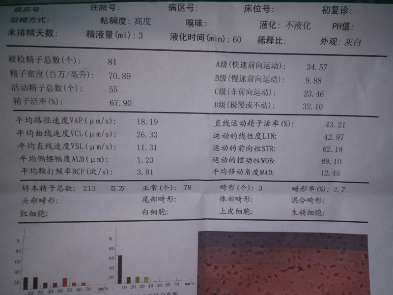 精子报告正常参考值图(精子常规检查的正常值)