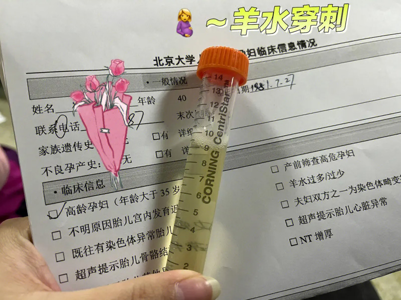 羊水穿刺正常报告单图片(羊水穿刺报告单46xn是什么意思)