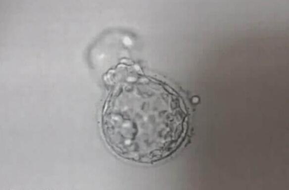 胚胎移植不着床的原因(附3个因素)