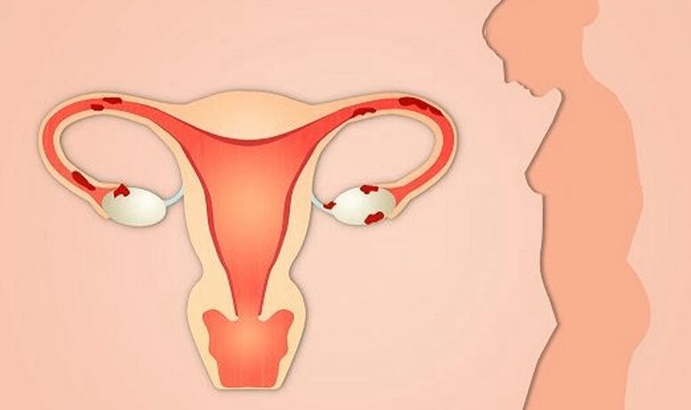 孕期出现空孕囊的原因(空孕囊的预防措施)