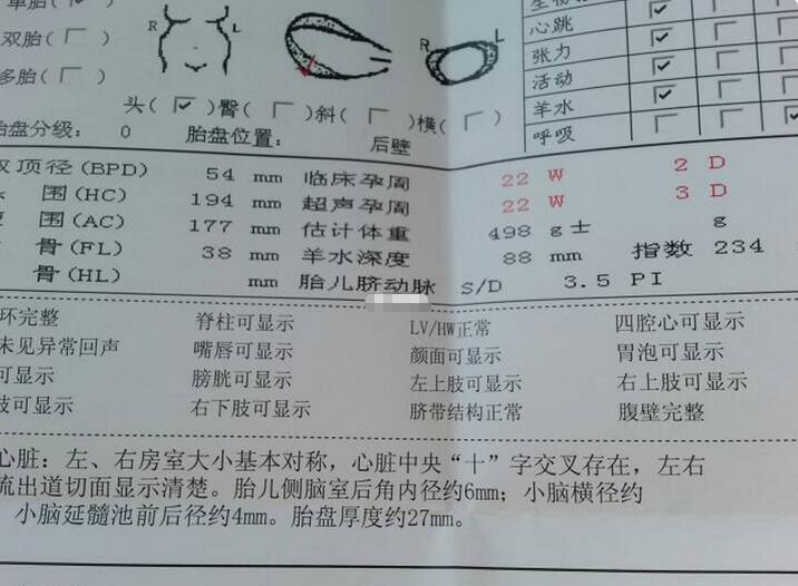 孕12周nt结果暗示男女怎么看(十二周nt看男女真的准吗)