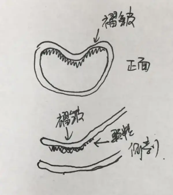 正常阴脣是什么样子的？
