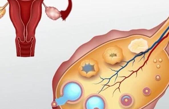 卵巢早衰的症状有哪些(女人卵巢怎么保养)