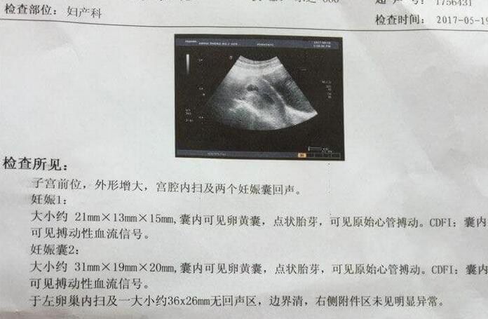 孕前、孕中子宫前位的原因(子宫后位变前位的原因)