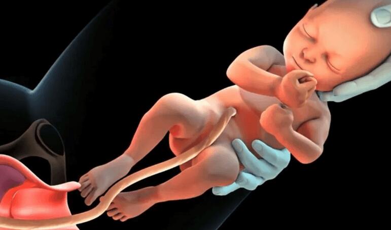 胎儿宫内窘迫是什么原因(附母体、胎儿异常和胎盘脐带异常因素导致)