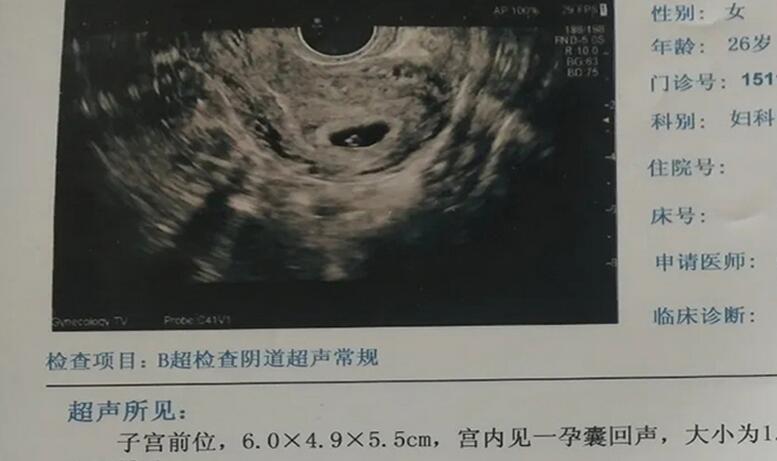 鱼鳞病能结婚生小孩吗(孕妇得了鱼鳞病要注意的事项)