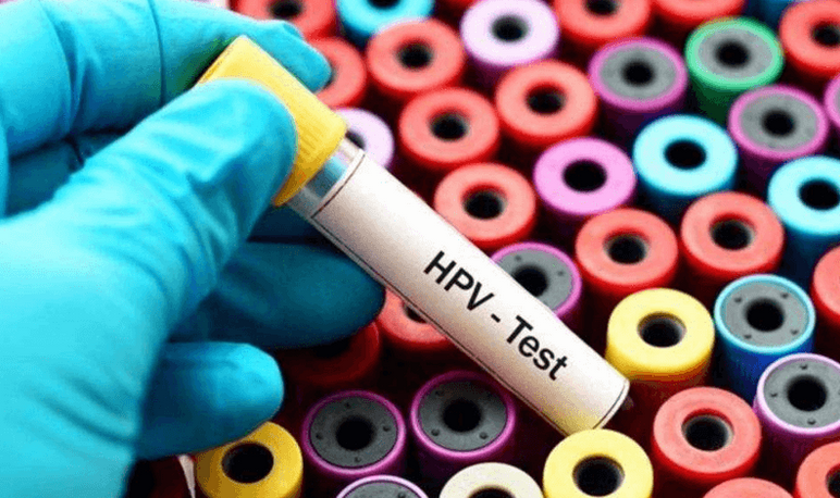 30岁以下为什么不建议检查hpv(男性30岁后需做的八项检查)