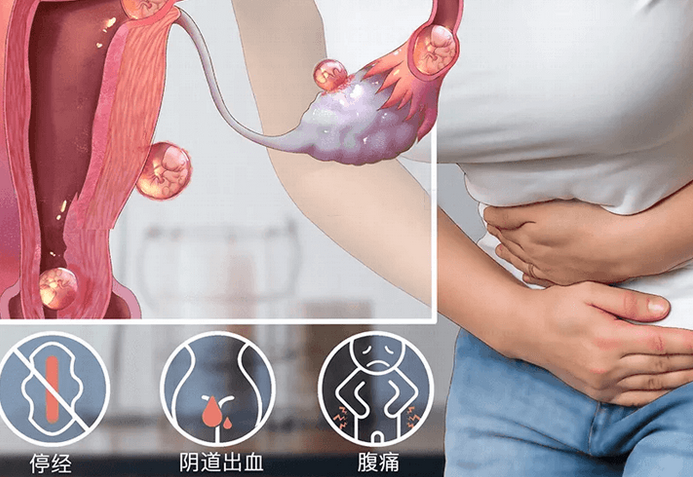 卵巢黄体破裂是什么意思(黄体破裂会导致什么后果)
