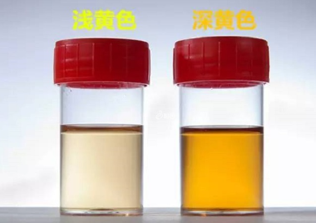 怀男孩的晨尿颜色是什么样的？孕期晨尿颜色究竟能不能看生男生女