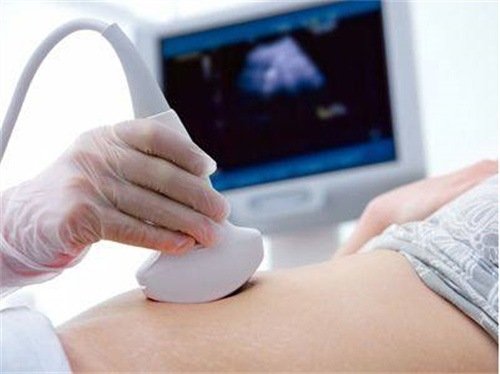 谁说产后42天复查是个坑！女性产后42天复查的好处多多哦