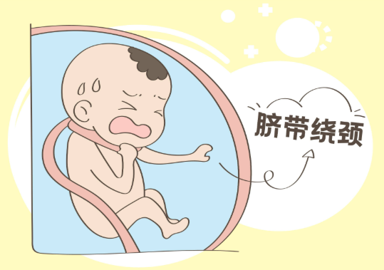 孕晚期脐带绕颈一圈怎么办（如何预防孕晚期脐带绕颈）