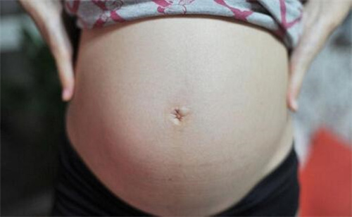 怀孕生子有妊娠纹如何消除？教你7招淡化妊娠纹不是问题