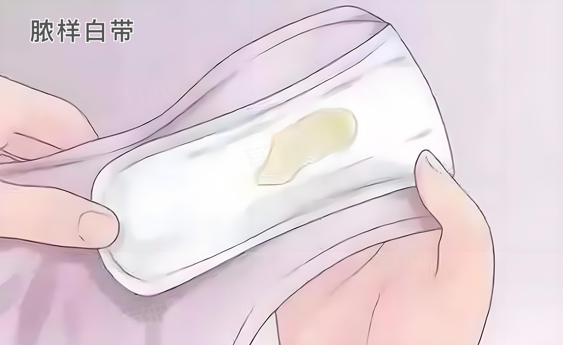 子宫瘤子有什么样子的症状？