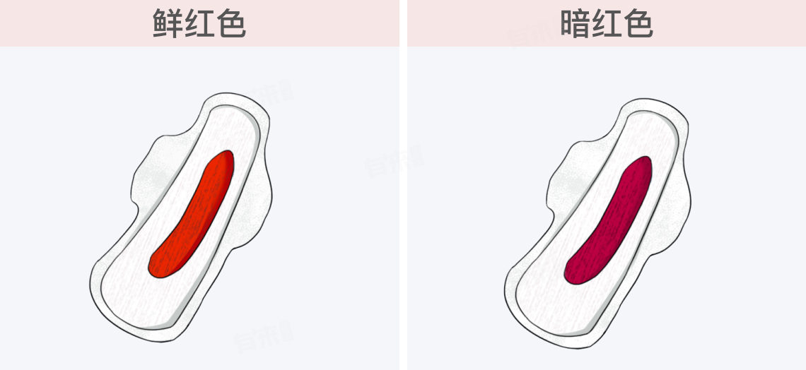 阴道癌的症状是什么样的？