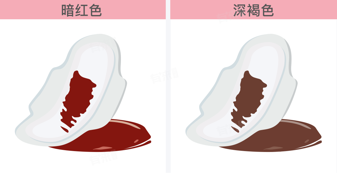 宫外孕会有什么样的症状表现？