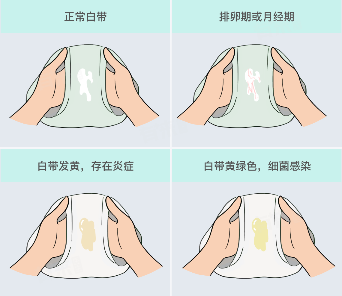 正常的白色分泌物什么颜色？