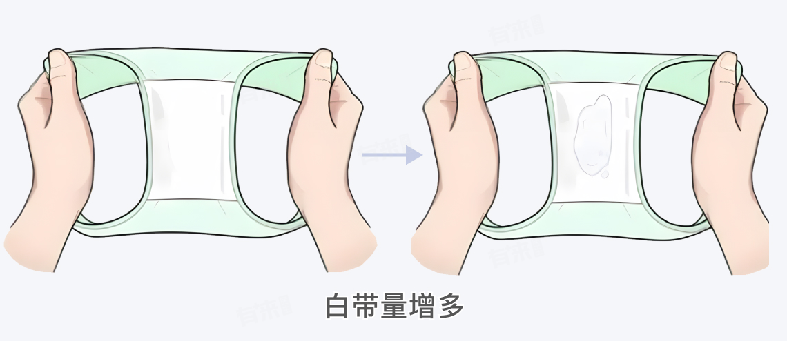 怀孕后白带是什么样子？