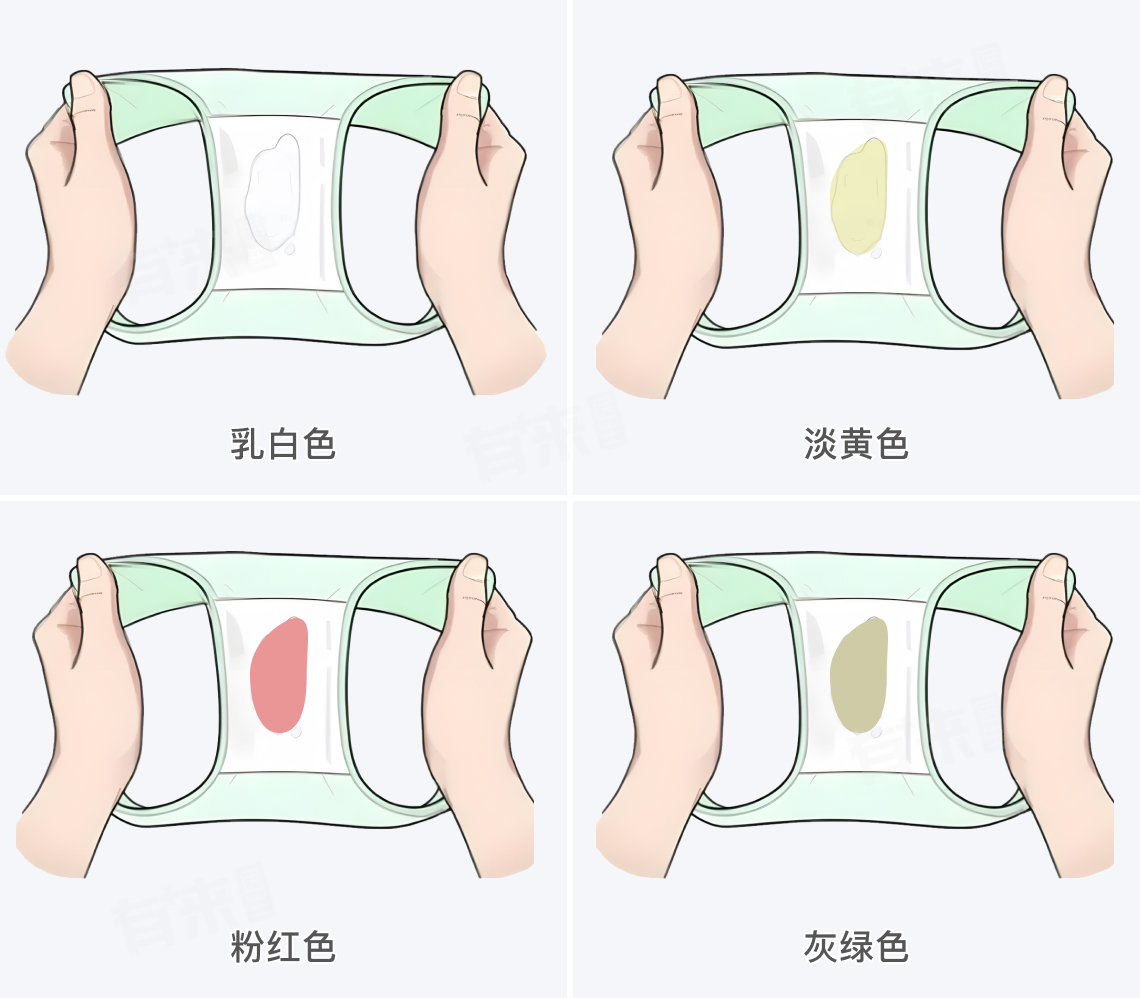 怀孕后白带是什么样子？