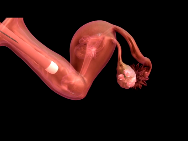 孕早期出血=流产？先别慌！分情况判断是否需要紧急就医