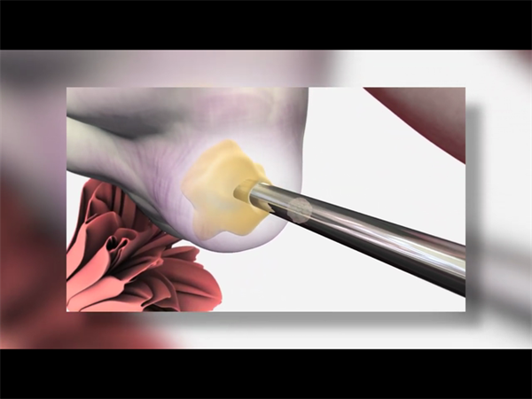 孕早期出血=流产？先别慌！分情况判断是否需要紧急就医