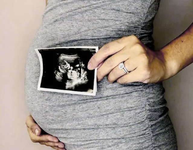 孕期运动禁忌清单：哪些动作绝对不能做？安全锻炼指南