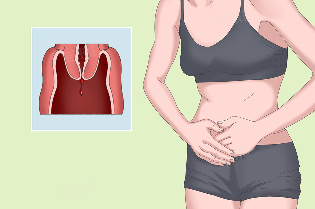 昨晚同房今天来例假会怀孕吗？附女性来