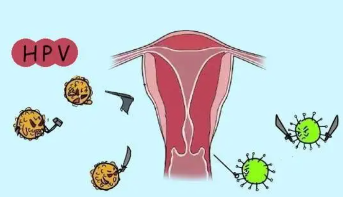 打了HPV疫苗≠高枕无忧！定期宫颈筛查同样不可忽视