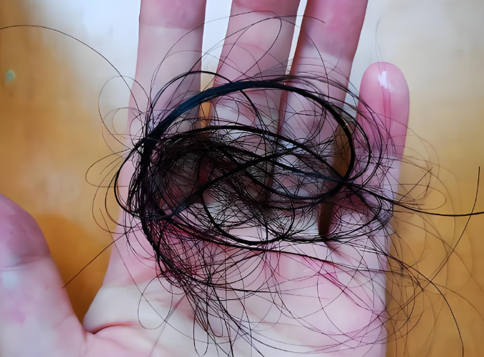 高龄产后脱发严重怎么办？这3种食疗方帮你守住发际线