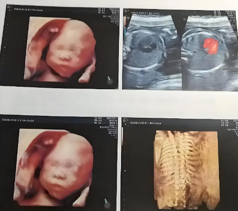 24周大排畸是看性别的最佳时机？错过这次还要等多久？