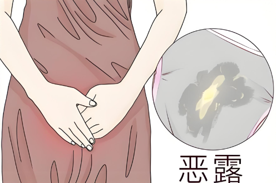 恶露干净后多久可以开始私密恢复？把握产后黄金42天