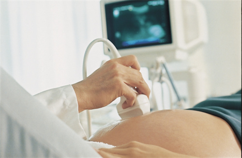 为什么做了无创DNA还要做大排畸B超？两者的排畸侧重点有何不同