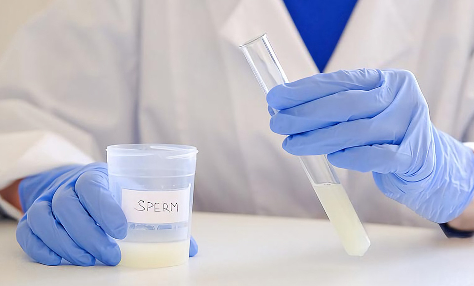 男性精索静脉曲张必须做手术才能怀孕吗？轻中重度分类处理建议