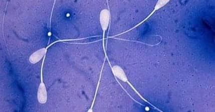 精子畸形率99%还能不能生？只要这个数正常,照样怀健康宝宝