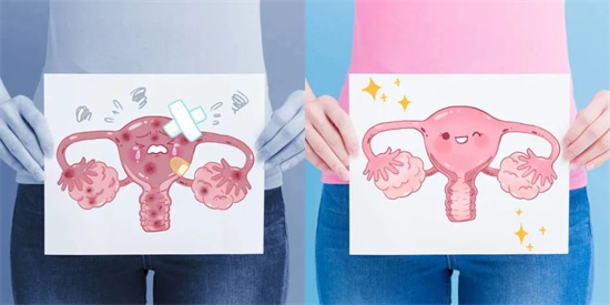 胖多囊怎么减肥最不伤身？为什么多囊患者比普通人更难掉秤