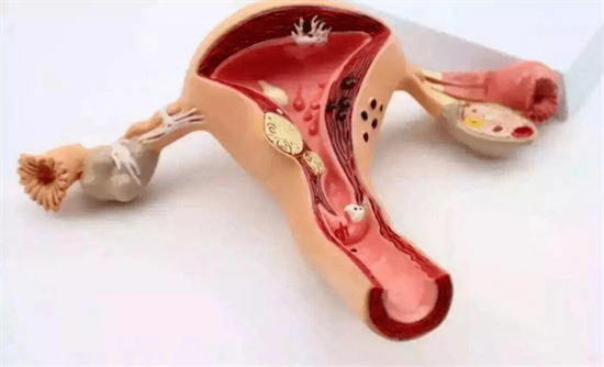 治疗多囊的偏方可信吗？揭秘那些宣称一个月治愈PCOS的骗局