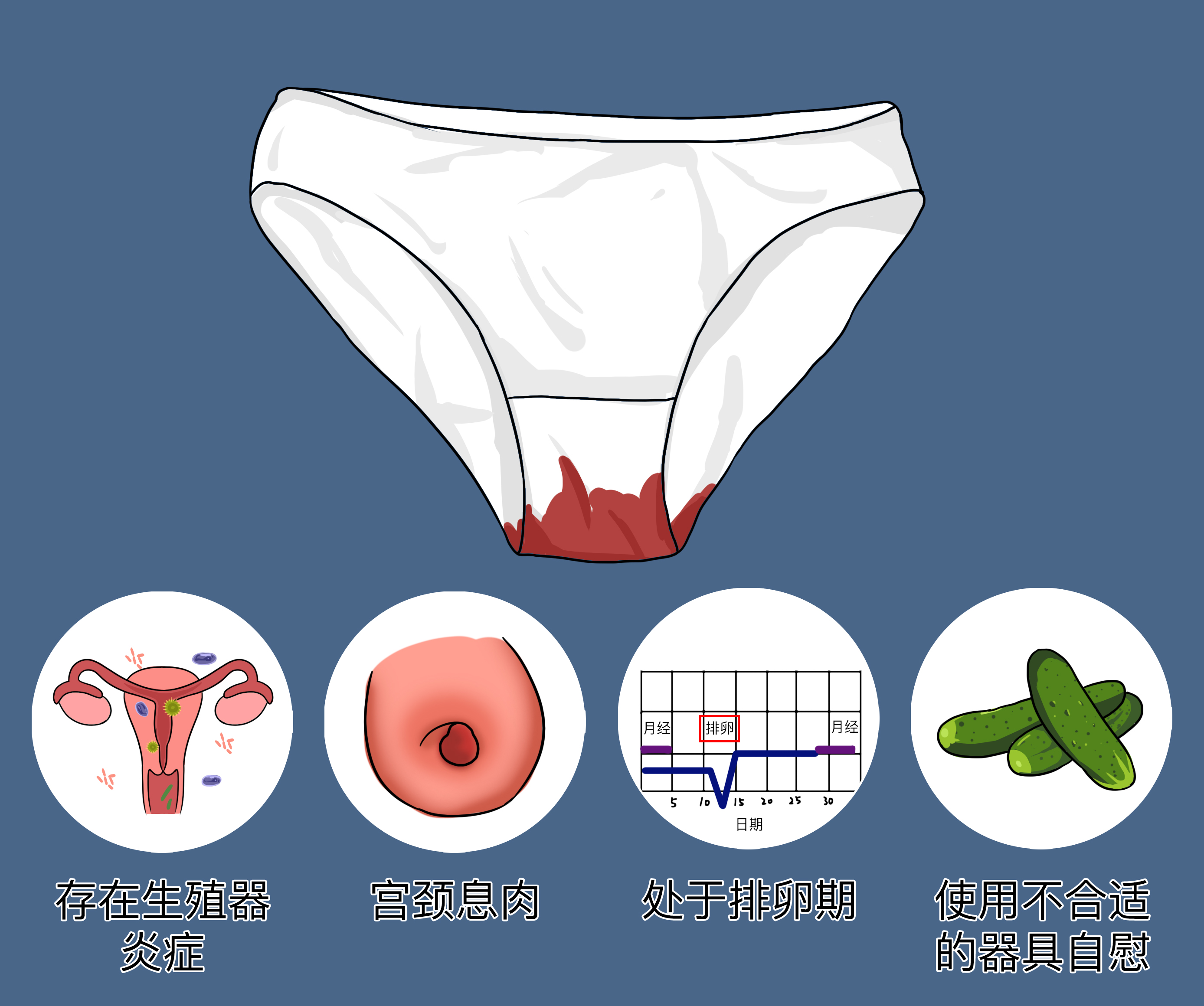 阴道自慰出血是怎么回事