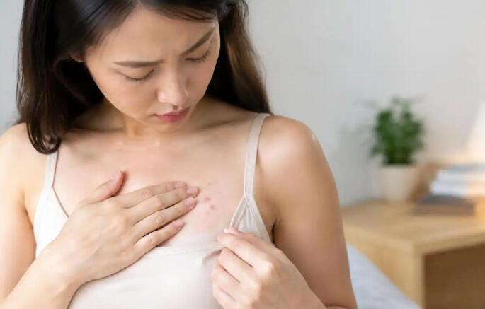 乳房上长了疙瘩别急着当小事！是普通皮肤问题还是乳腺异常？看这4个区别