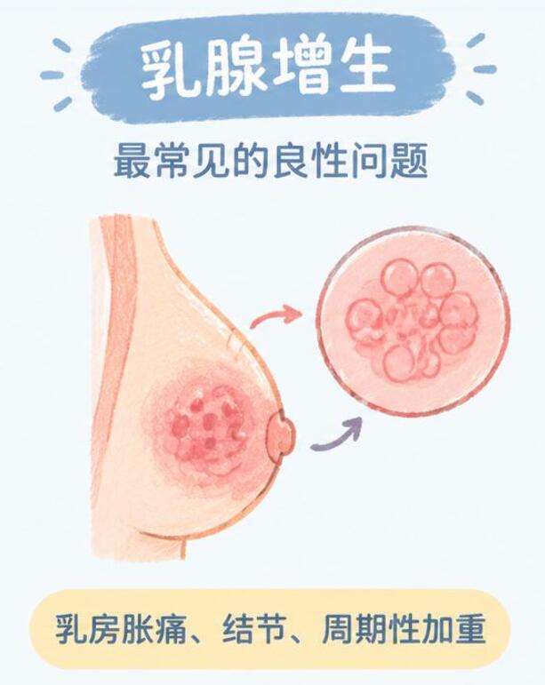 女性乳房疾病常见的有哪些？乳腺问题可大可小，这份科普请收好