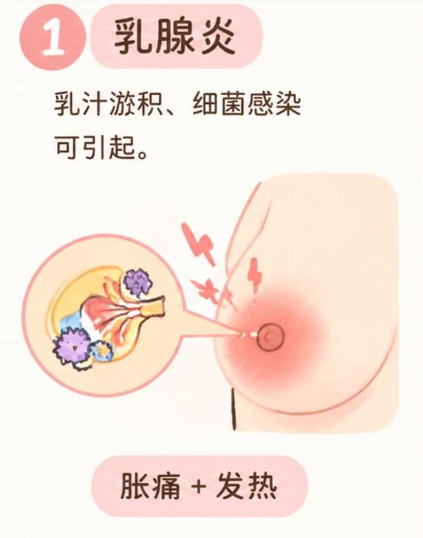 哺乳期乳房胀痛发烧是什么原因？