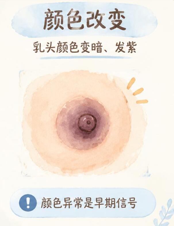 乳头出现这些变化要当心！早期识别很关键