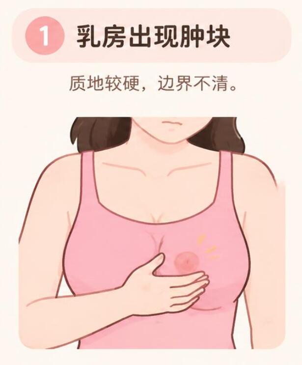 乳腺癌早期有什么症状？