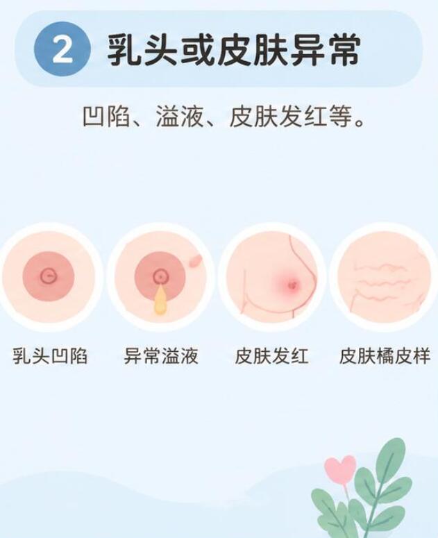 乳腺癌早期有什么症状？