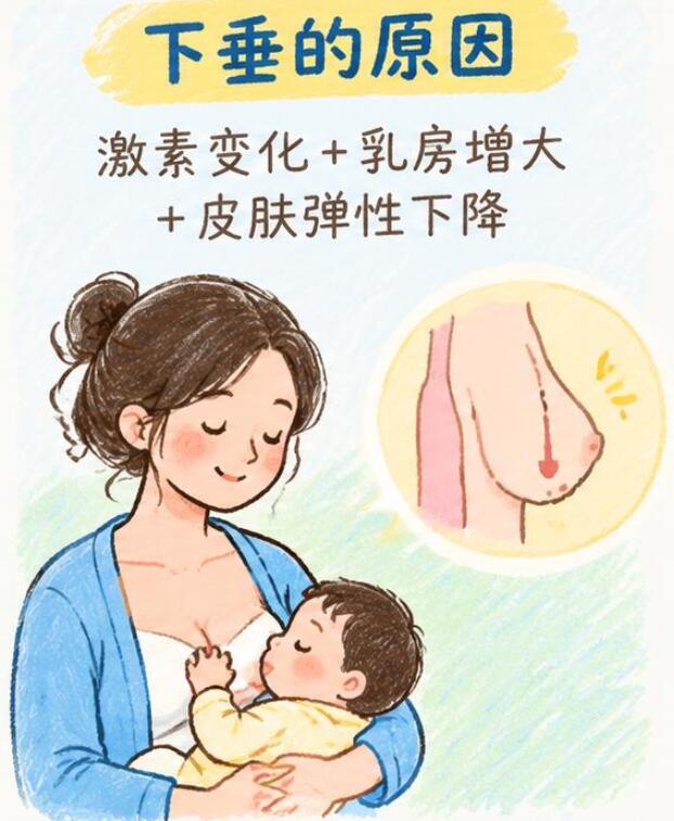 哺乳期乳腺炎应该看乳腺外科吗？这些情况要尽快就医