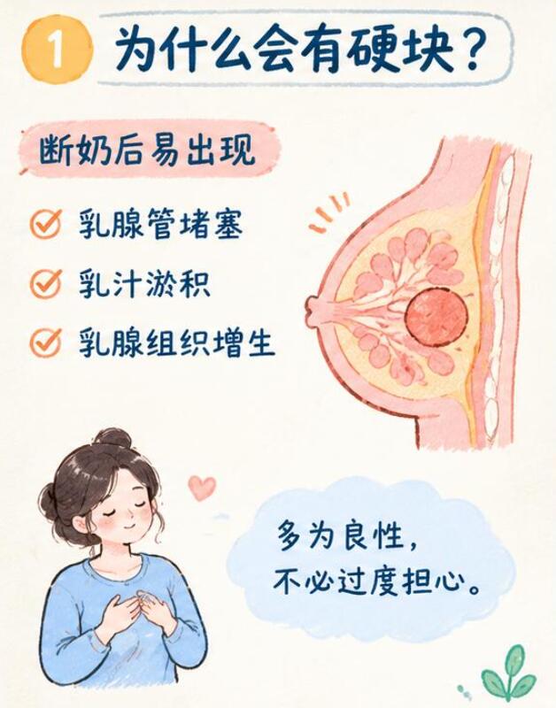 断奶后乳房有硬块回奶后硬块会消失吗？