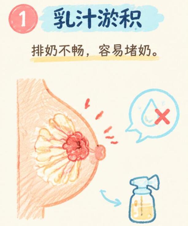 哺乳期乳腺炎反复发作？这些诱因很多人不知道！