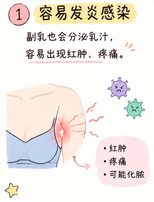 副乳不切除，身体会悄悄发生什么？