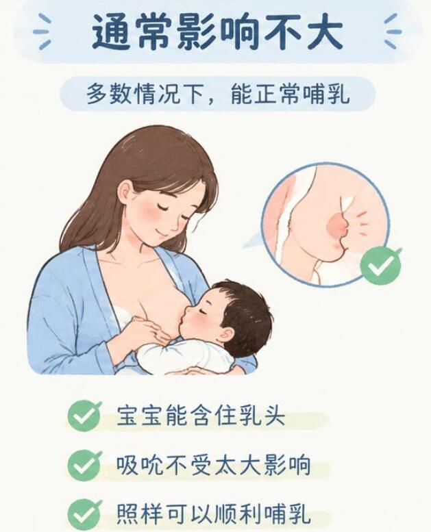 乳头小会影响以后哺乳吗？