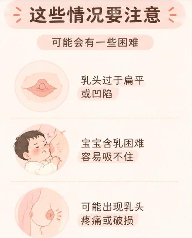 乳头小会影响以后哺乳吗？