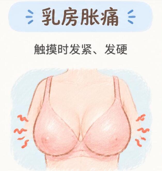哺乳期乳房水肿有什么症状？很多妈妈容易和堵奶混淆，今天一次讲清楚